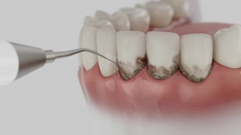 Trusted Teeth Cleaning And Checkup service in Santa Clarita, CA - Dentist Open Now